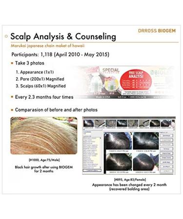 Dr Ross BIOGEM pH-Balanced Revitalizing Shampoo for Oily Hair - 355ml | Shop Internationally for Healthy Hair - Buy Online on GoSupps.com