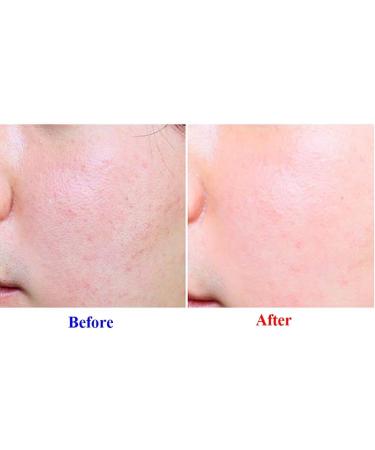 WHITESILK K-Beauty PERFECT 9 Repair Stem cell Night Shift Serum dryness wrinkles flakiness darkening blemishes refines pores skin elasticity (50ml) - Buy Online on GoSupps.com
