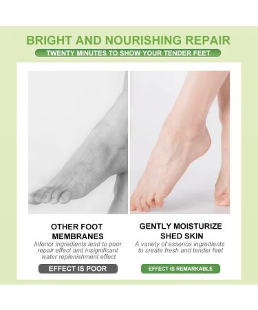 Foot Mask Socks 2 Pairs Avocado Feet Moisturising Socks Skincare Socks For Women Foot Spa Repair For Dry Feet Hard Cracked Heels Calluses Cuticles Rough Skin 2PC - Buy Online on GoSupps.com
