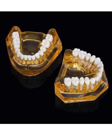 LBYLYH Adult Tooth Replica Model - Medical Dental Teaching Tool for Professionals | International Shipping - Buy Online on GoSupps.com