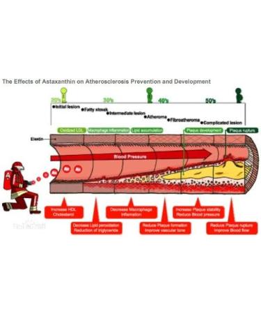 WonderLand Herbs 100% Haematococcus pluvialis Supercritical Extraction AO Astaxanthin Oil (ASTA) 5% HPLC 100 Grams (3.4 Fl oz.) The Strongest antioxidants Supplement Free Radical scavenging - Buy Online on GoSupps.com