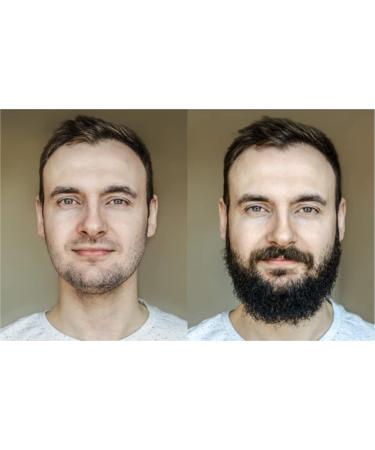 Men's Strong Beard Growth Kit - Beard Balm, Oil, Serum & Derma Roller Set for Natural Beard & Mustache Grooming - Promotes Healthy Beard Growth - Buy Online on GoSupps.com