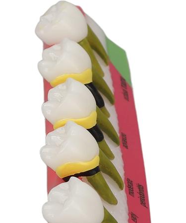 Dental Parodontitis Model - Visualize Stages & Improve Communication Between Dentists and Patients | International Shipping - Buy Online on GoSupps.com