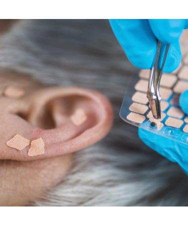 Buy 600 Piece Ear Acupuncture Set - Acupressure Stick Massage Pen & Tweezer for Holistic Healing - Buy Online on GoSupps.com