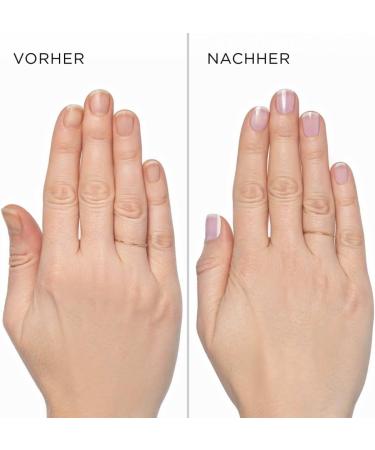 ARTDECO Nail Whitener French Rose - Nail Brightening Treatment - Buy Online on GoSupps.com