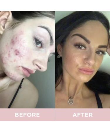 Revive Collagen Premium Hydrolyzed Marine Collagen Drink for Women 8 500MG with Hyaluronic Acid Aloe Vera Juice Revive Skin Health Hydration Hair & Skin Lemon & Lime Flavour 14 Sachets - Buy Online on GoSupps.com