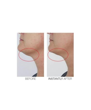 Mirenesse Cosmetics Chin Tuck V Shape Lifting Serum - Lift and Firm Your Jawline - Buy Online on GoSupps.com