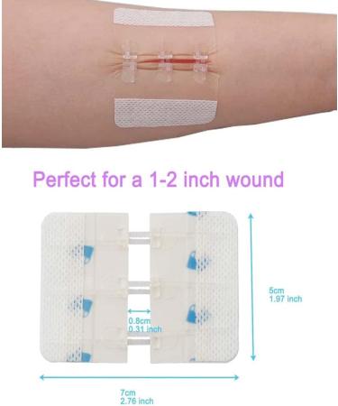Vrilmed Zip Sutures Wound Closure Device - Non-Woven Fabric Butterfly Bandages for First Aid Laceration Repair - Scar-Free Wound Care - Spec 03 - Buy Online on GoSupps.com
