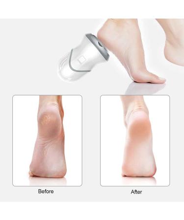 Electric Foot Grinder Exfoliating Foot Callus Dead Skin Remover Foot Care Pedicure Tools for Removing Calluses Cracked Dry Dead Skin - Buy Online on GoSupps.com
