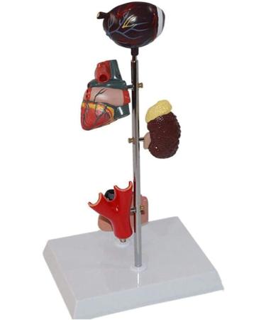 Dytah Pathological Diabetes Model - 5-Part Educational Kit for Eye Heart Kidney Artery & Foot Training | International Shipping Available - Buy Online on GoSupps.com