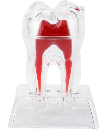 Discriminable Toothed Tooth Model for Endodontics | Plastic Teeth Teaching Material for Dental Studies & Research | International Shipping Available - Buy Online on GoSupps.com