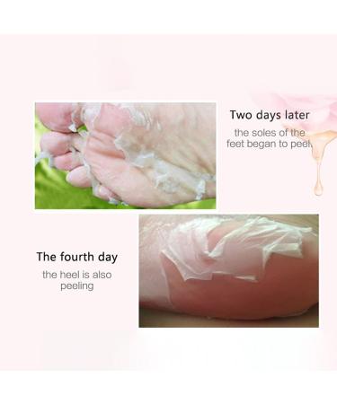 Allbestaye Rose Feet Peeling Foot Mask | Exfoliating Socks for Pedicure & Dead Skin Remover Foot Care Solution for Calluses - Buy Online on GoSupps.com