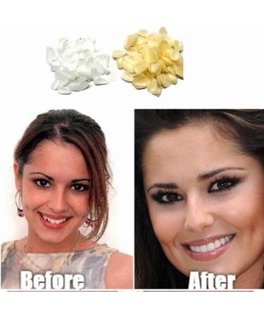 Fake Temporary Tooth Repair Kit - Fix Missing Broken Teeth & Gaps | Natural Yellow Artificial Teeth for a Confident Smile | Includes Magnetic Mirror Box - Buy Online on GoSupps.com