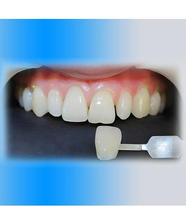 Dental Resin Kit for DIY False Teeth - 4 Sets for Filling or Creating Missing Teeth - Perfect for Horror Props - Buy Online on GoSupps.com