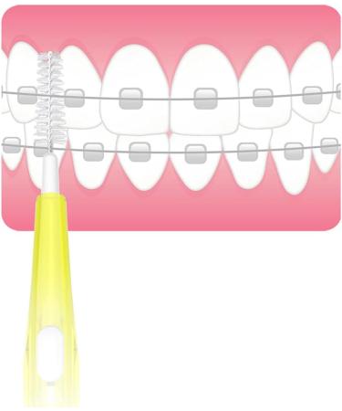 Buy 0.6 1.5 mm Interdental Brush Set - Essential Toothpick Tools for Effective Dental Care | International Shipping Available - Buy Online on GoSupps.com