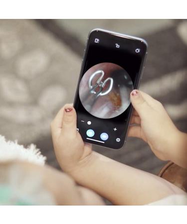 Premium Ear Wax Removal Otoscope & Curette - HD Camera with LED Lights for iPhone & Android | Ideal for Kids Adults & Pets - Buy Online on GoSupps.com