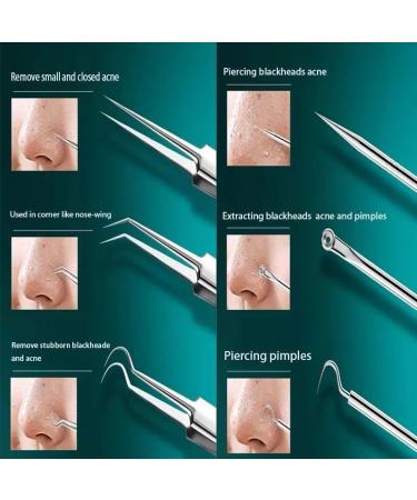 Hair Tweezers Acne Blackhead Removal Needles Black Dots Cleaner Pore Cleaner - Buy Online on GoSupps.com