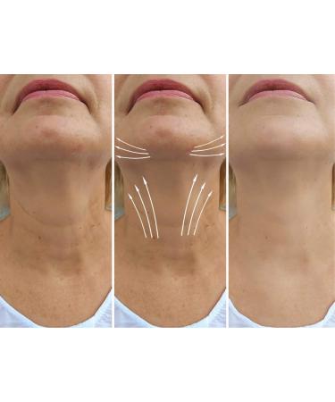 N.E.C.K Control: Neck Lifting Firming & Retracting Cream - Best Anti-Aging Solution for a Youthful Neck | Shop Now Internationally - Buy Online on GoSupps.com