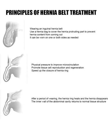Samnuerly Inguinal Hernia Band - Adjustable Hip Belt for Men with Removable Compression Support - Buy Online on GoSupps.com