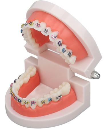 Orthodontic Tooth Model with Metal Brackets - Ideal for Teaching & Research in Laboratories | International Shipping - Buy Online on GoSupps.com