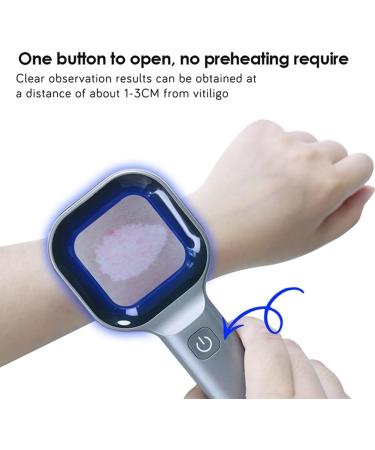 jumbans 1 Piece Portable Salon Beauty Analyzer UV Lamp Wood Dermatology for Analyzing Testing - Buy Online on GoSupps.com