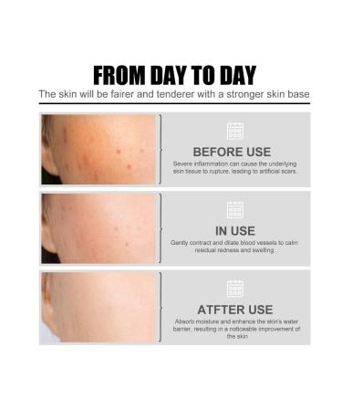 2pcs Nourishing Face Serum Shrinking Pores Brightening Skin Rejuvenation Eye Bags Removing Dark Circles Moisturizing Facial Essence - Buy Online on GoSupps.com