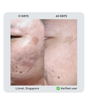 nor sken Reverse-aging Natural Vegan Facial Cream to Increase Skin Elasticity and Collagen Decrease Wrinkles and Redness - Buy Online on GoSupps.com