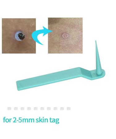Fast Wart Removal Kit - 30PC Safe & Painless Micro Bands for Face Neck & Body - Buy Online on GoSupps.com