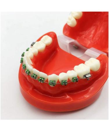 Buy LBYLYH Orthodontic Dental Demonstration Template - TypoDont Teeth Model with Ligature Support for Effective Orthodontic Training | International Shipping Available - Buy Online on GoSupps.com
