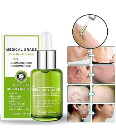 30ml Goopgen Medical Grade Scar Repair Serum - Nature Scar Treatment for All Types of Scars (1pcs) - Buy Online on GoSupps.com
