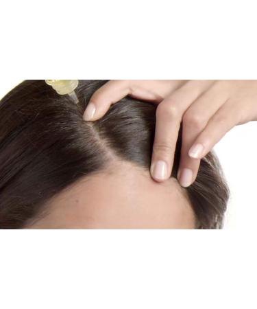 Scalp Lotion Ampoules 6 ml - Nourish & Revitalize Your Hair | International Shipping Available - Buy Online on GoSupps.com
