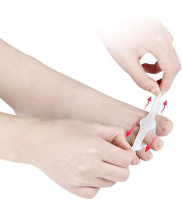 PEDIMEND Silicone Gel Toe Separators with 2 Loops (1 Pair) - Pain Relief for Bunions & Overlapping Toes - Prevent Calluses & Corns - Unisex Twin Toe Separator - Buy Online on GoSupps.com