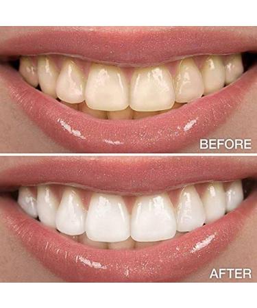 XL Teeth Whitening Pen 4cc - 20+ Uses, 44% Carbamide Peroxide Gel - Strong Stain Remover, Made in USA - Buy Online on GoSupps.com
