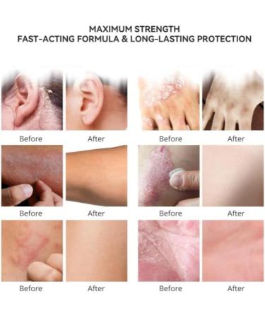 Miracle Manuka Cream Skin Repairing Ointment Moisturizer For Sensitive Skin Softens And Moisturizes Dry Skin 100 G353oz 1 pcs - Buy Online on GoSupps.com