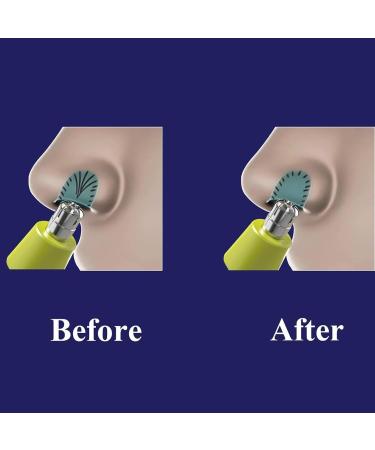 Nose Hair Trimmer Replacement Blades for OneBlade QP2520 QP2630 QP2620 QP2724 & Pro 360 QP6551 - Premium Trimming Attachments - Buy Online on GoSupps.com