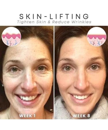 3pcs Botox Stock Solution Facial Serum - 2023 Newest Anti-Wrinkle & Anti-Aging Treatment endorsed by Jennifer Aniston - Buy Online on GoSupps.com