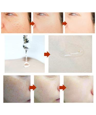 24K Gold Face Essence with Hyaluronic Acid Serum for Anti-Aging and Wrinkle Reduction - Moisturizing and Firming Treatment for Skin Care - Buy Online on GoSupps.com