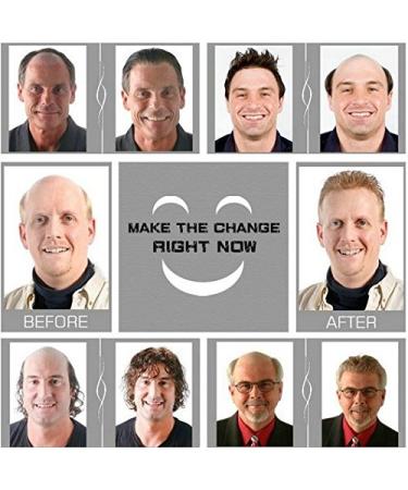 Buy Premium Human Hair Toupee for Men - NLW 10x8 Jet Black Lace Hairpiece | Natural & Breathable Replacement System - Buy Online on GoSupps.com