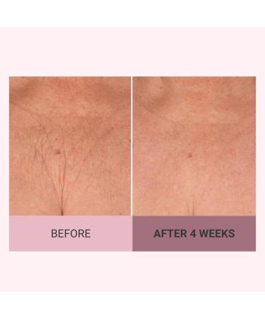 Consult Beaute Champagne Lift Hydrating Firming Body Cream with Pink Pepperslim Tightens Tones Crepey Skin Moisturizer for Dry Skin Warm Santal 8 oz. - Buy Online on GoSupps.com