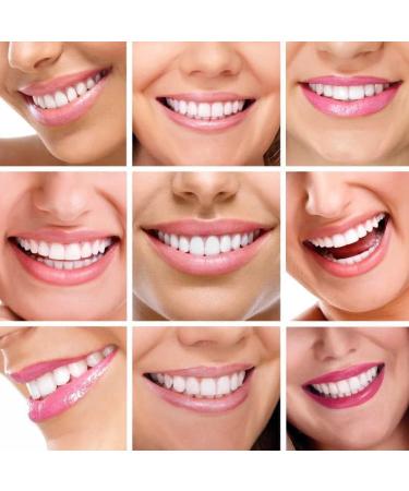 Fluktrix Cosmetic Teeth Veneers - Temporary Comfortable Smile Enhancers for Upper & Lower Teeth - 2 Pairs - Buy Online on GoSupps.com