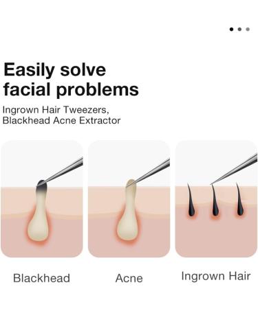 Acne Needle Ingrown Hair Tweezers Needle Nose Pointed Tips Eyebrows Tweezers for Splinters Blackhead Extractor (Color : Mr-2191S) - Buy Online on GoSupps.com