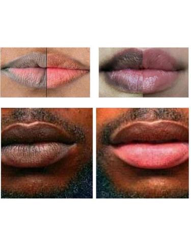 Lip Lightening for Dark Lips Lip Brightener for Smokers Dark Lip Treatment Lightening Cream for Pink Lips Lip Lightener for Smoker Lips Lip Lightening balm for Men and Women - Buy Online on GoSupps.com
