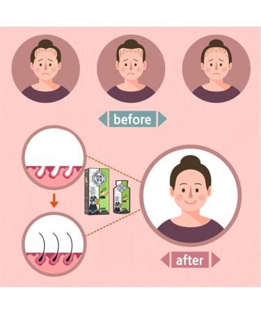 Suchkeit Ginger Plant Extract Anti-Hair Loss Hair Shampoo Ginger Extract Shampoo Smooth and Oil Control Nourishing Shampoo Shampoo for Hair Thickening Hair Strengthening - Buy Online on GoSupps.com