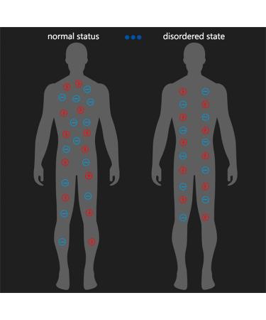 Nimedala Redup Far Infrared Negative Ion Bracelet - Anti-Static Sports Bracelet for Men & Women (Black X 2) - Shop Internationally - Buy Online on GoSupps.com