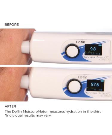 NassifMD 3HA Instant Hydrating Facial Mist - Contains 3 Types of Hyaluronic Acid to Keep Your Face Refreshed and Hydrated Decreases Look of Skin Puffiness Dark Circles and Fine Lines 4 Fl Oz (Pack of 1) - Buy Online on GoSupps.com