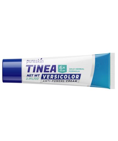 Tinea Versicolor Treatment Antifungal Cream: Extra Strength Natural Anti Fungal Anti Itch - for Tinea Versicolor Ringworm Athlete's Foot Jock Itch Purple