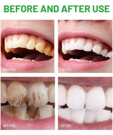DISAAR Beauty Rosemary Toothpaste Herbal Extract Clove Probiotics Removes Stains Stronger Teeth 100g / 3.38oz - Buy Online on GoSupps.com