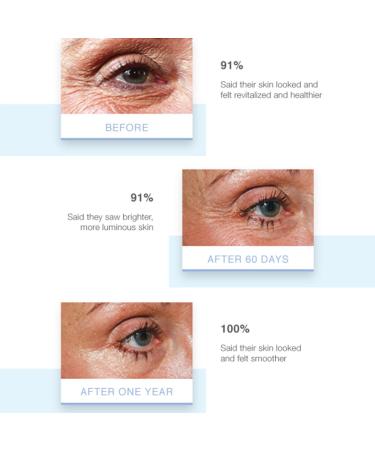 Elevate Eye Cr me | Age-Defying Growth Factors to Reduce Fine Lines & Wrinkles - Shop Internationally - Buy Online on GoSupps.com