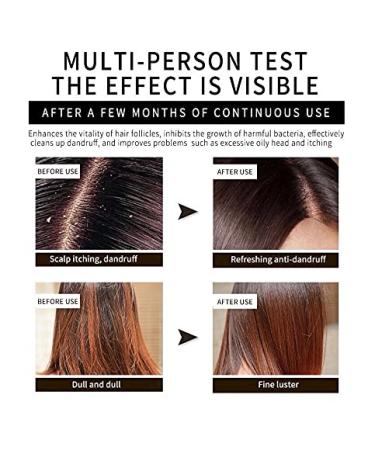 Natural Handmade Shampoo Bar - 100% Organic Ginger Hair Wash for Soft Glossy Hair | Eco-Friendly Set of 2 - Nourish Scalp & Moisturize - Buy Online on GoSupps.com