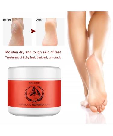 2ST Foot Cream - Moisturizing Peeling Butter for Dead Skin | Best Foot Care Lotion & Accessories - Buy Online on GoSupps.com